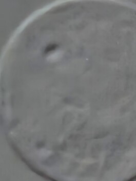 studio pointer* - A Thousand Phantom Moons: an investigation into concealed superresolution mechanisms