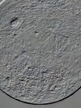 studio pointer* - A Thousand Phantom Moons: an investigation into concealed superresolution mechanisms