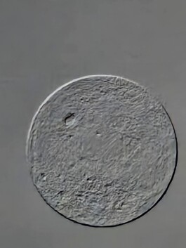 studio pointer* - A Thousand Phantom Moons: an investigation into concealed superresolution mechanisms