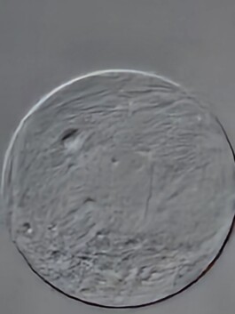 studio pointer* - A Thousand Phantom Moons: an investigation into concealed superresolution mechanisms